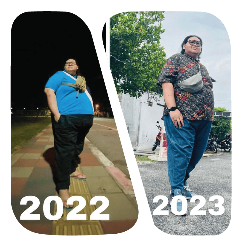 Best Weight Loss Surgery