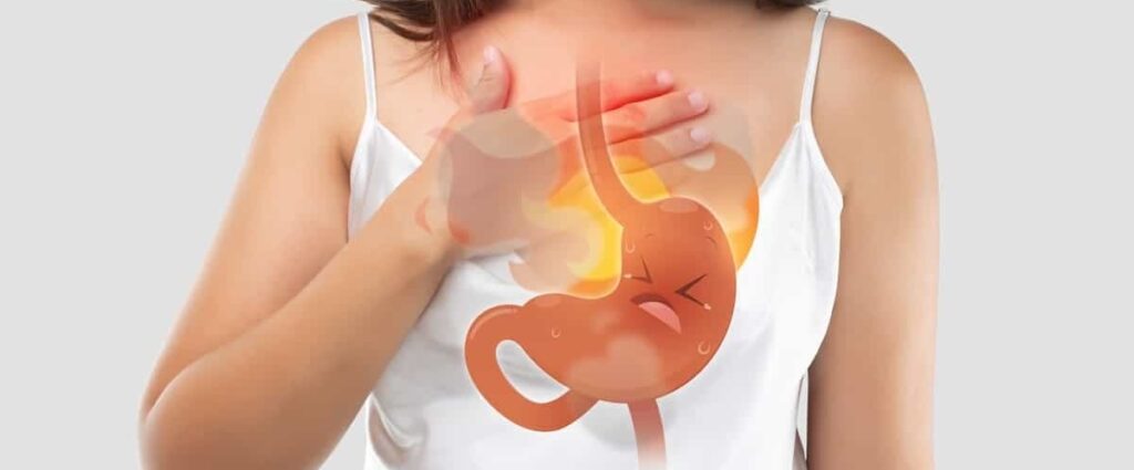 What Causes Heartburn and How to Treat It Naturally