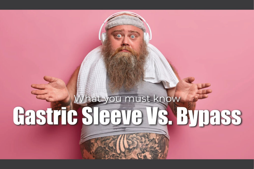 Gastric Sleeve vs. Gastric Bypass: What You Must Know