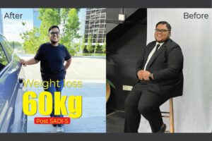 Weight loss surgery 60kg shahrul nizam SADI-S