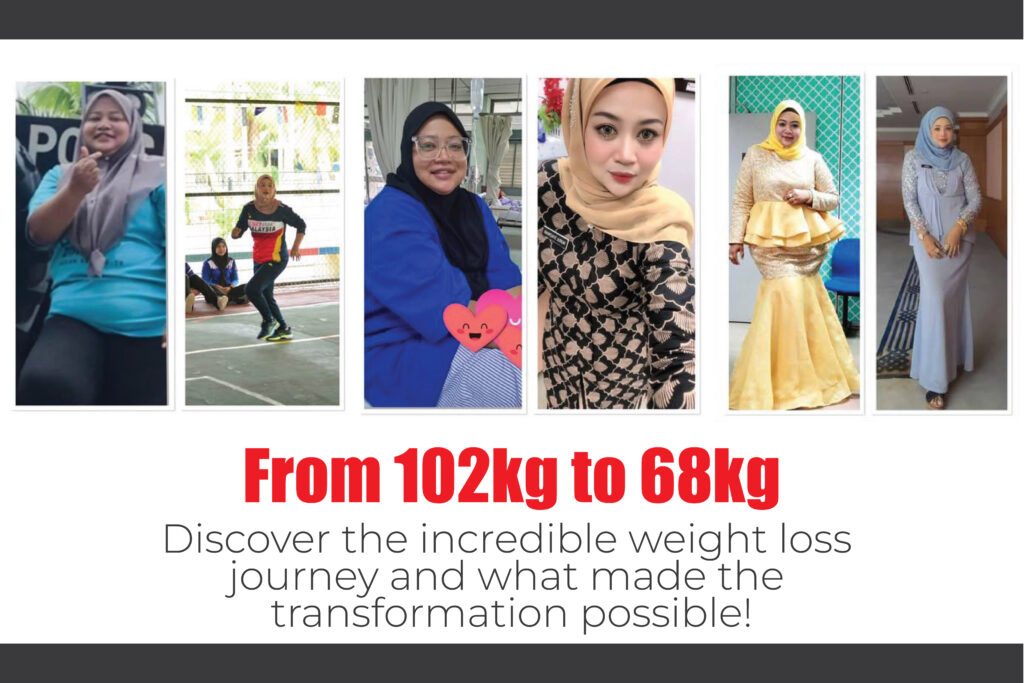 Weight Loss From 102kg to 68kg: Nurul Syazwani’s Incredible Weight Loss Journey After Sleeve Jejunal Bypass Surgery