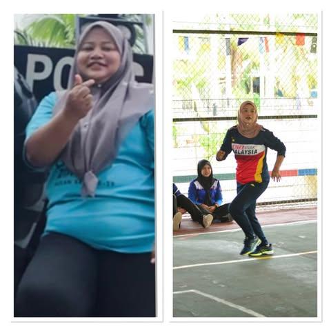 Weight Loss From 102kg to 68kg: Nurul Syazwani’s Incredible Weight Loss Journey After Sleeve Jejunal Bypass Surgery