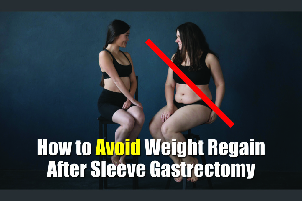 How to Avoid Weight Regain After Sleeve Gastrectomy​