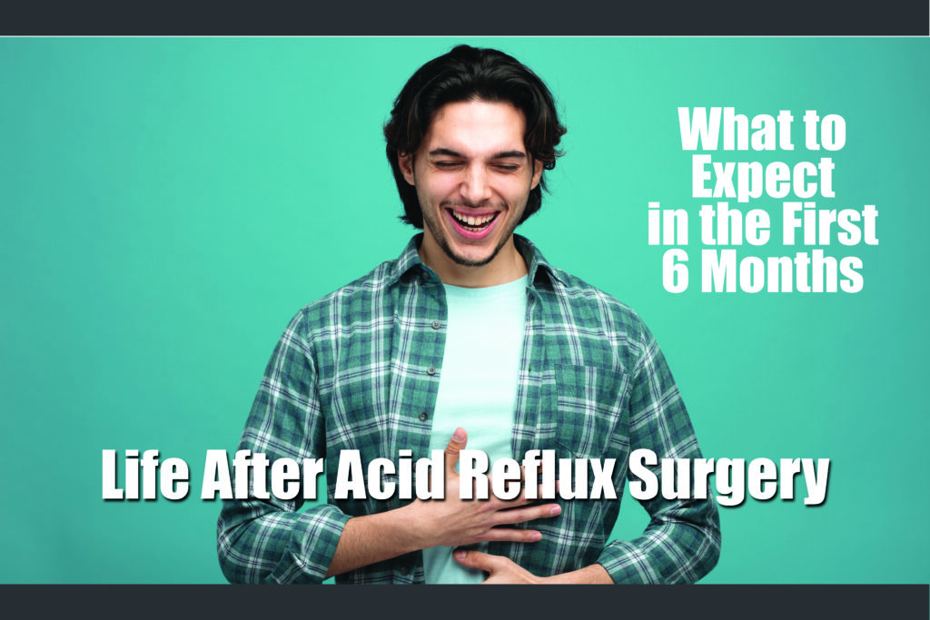 life after acid refulx surgery
