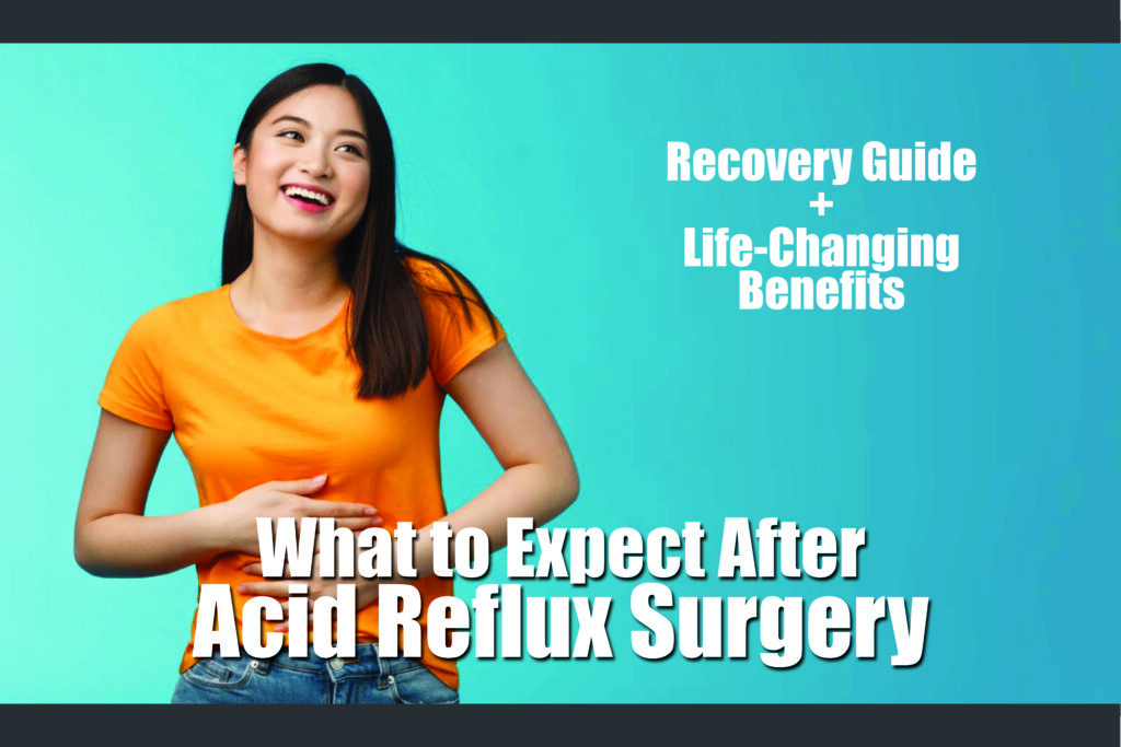 Recovering from acid reflux surgery