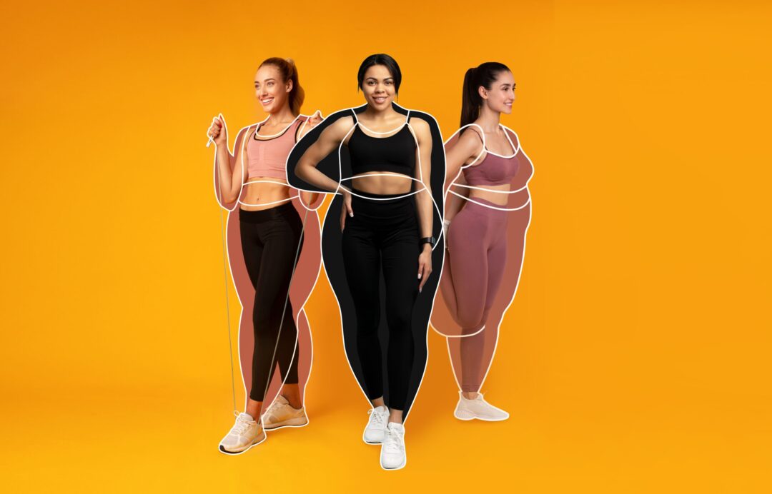 Sleeve Gastrectomy vs. Gastric Bypass: Which Is Better for Obesity in Malaysia?
