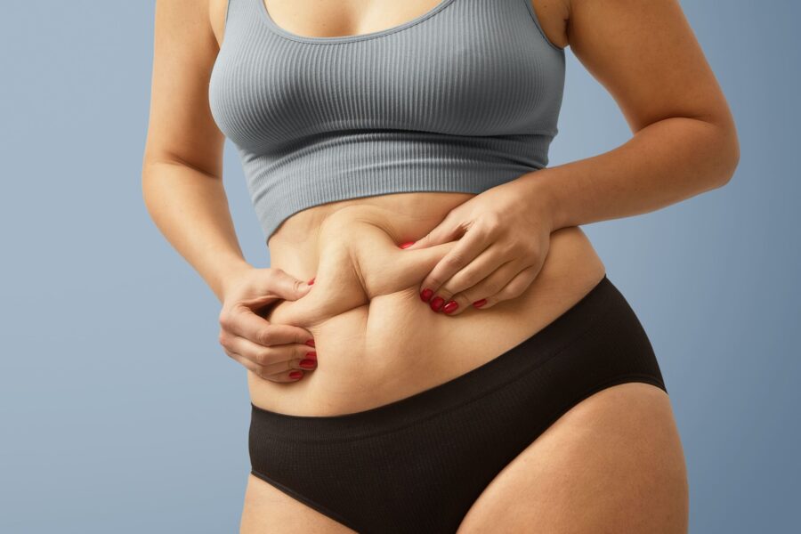 Can obesity surgery help with type 2 diabetes? Yes—learn how procedures like gastric bypass and sleeve gastrectomy can improve or even reverse diabetes.