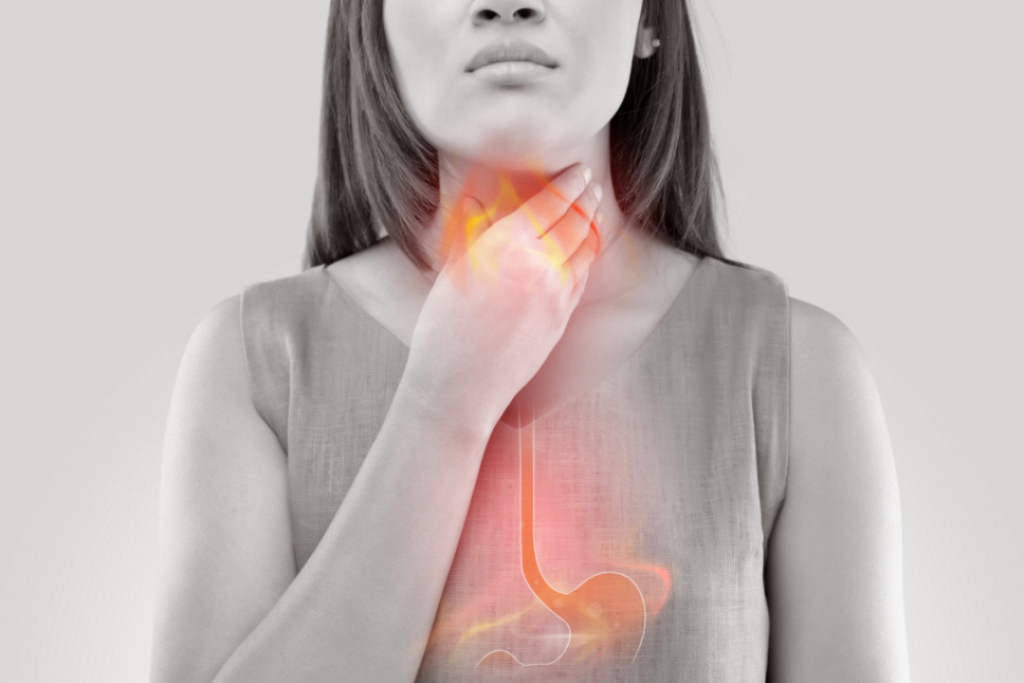 What Is Esophagitis? Warning Signs You Should Know