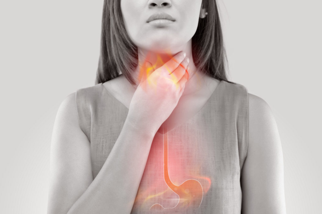 What Is Esophagitis? Warning Signs You Should Know